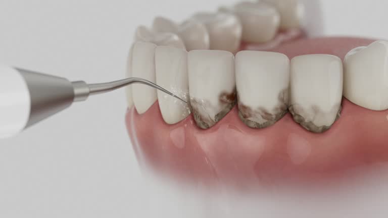 Reliable Dental Implants contractor in Nesconset, NY by Smile Center Dentistry